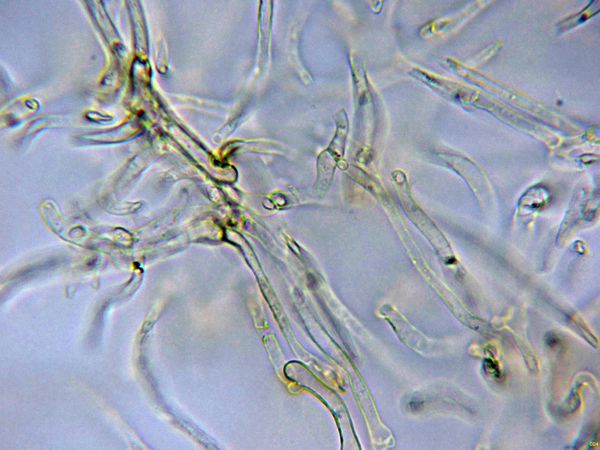 10 - Suprapellis agua-004